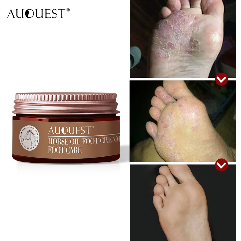 

Anti Crack Foot Cream Repair Rough Soften Old Dead Skin Cells Restore Smoothness Anti-aging Whitening Moisturizing