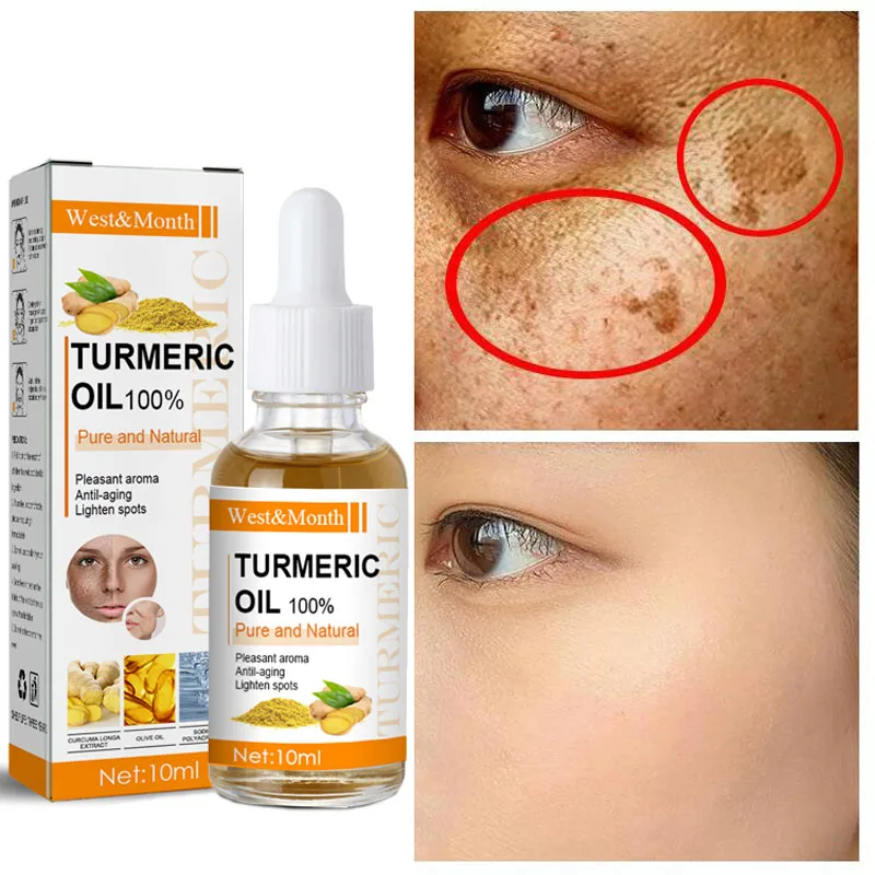 

Turmeric Whitening Freckles Serum Remove Dark Spots Lighten Melanin Melasma Brighten Skin Care Anti-aging Moisturizing Essence