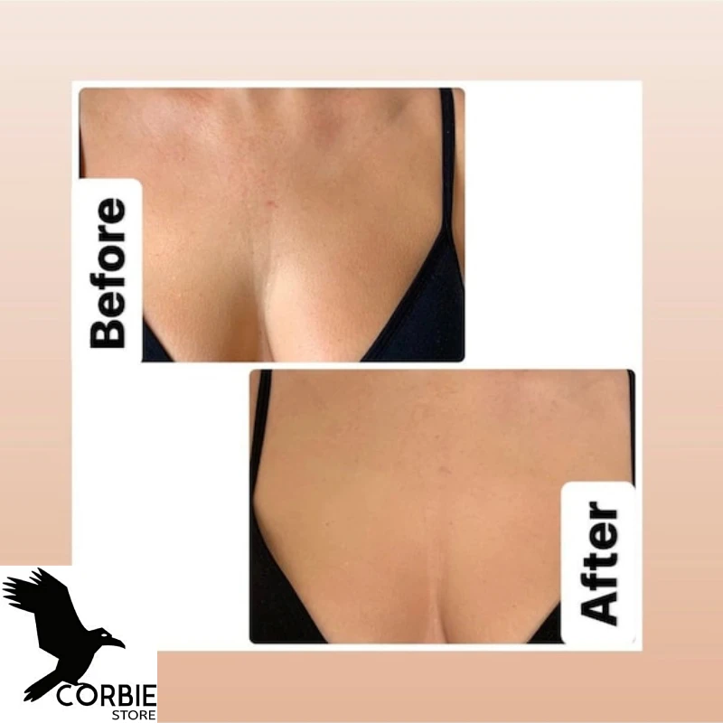 Breast Support Pillow Bust Decollete Wrinkle Prevention and Women's Underwear Women's Bra Large Size Breast Support