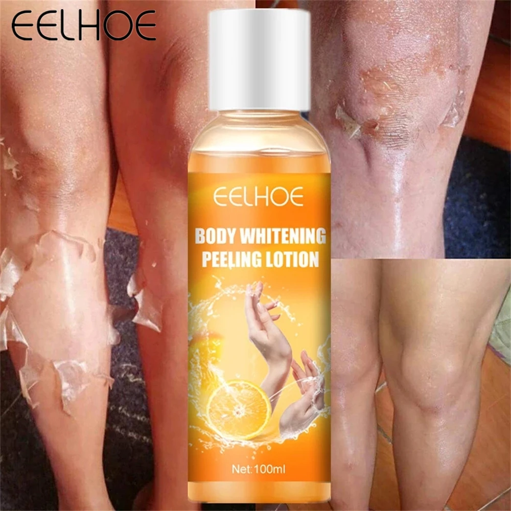 

EELHOE Body Whitening Peeling Lotion 100ML Body Care Insantly Whitening Peeling Gel Exfoliating Mask Fnger Knee Body Health Care