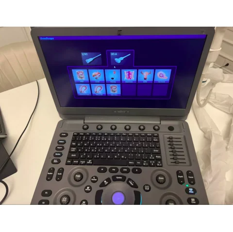 Ультразвуковой допплер Sonoscape E2 Pro + 2 датчика