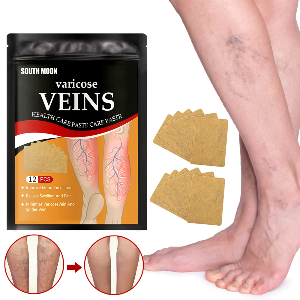 

12Pcs Thigh Leg Pain Spider Removal Varicose Veins Relief Patch Phlebitis Plaster Feet Anti Swelling for Foot Health Care