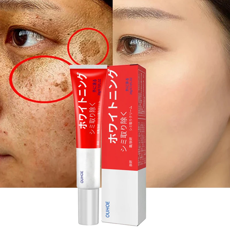

Effective Whitening Freckle Cream Remove Dark Spots Lighten Skin Melanin Melasma Remover Anti-Aging Brighten Face Skin Care 20g