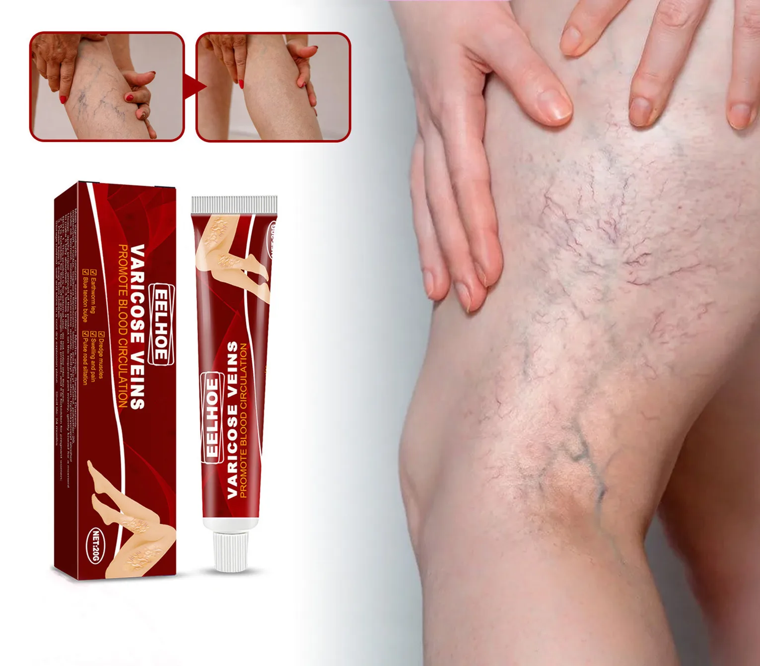 

Effective Herbal Varicose Veins Relief Cream Vasculitis Phlebitis Spider Pain Relief Ointment Herb Plaster Beauty Body Care 20g