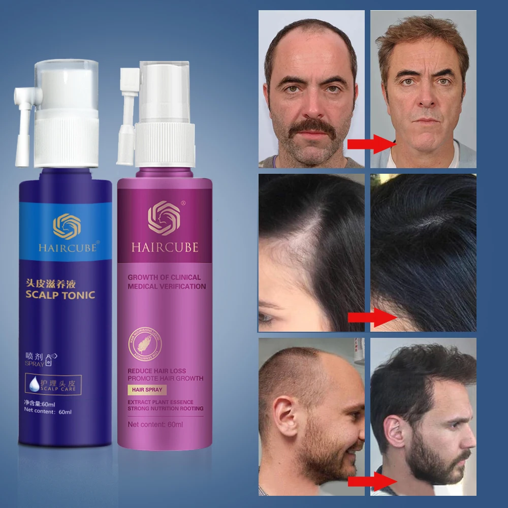 

HAIRCUBE Hair Growth Essence Spray Repair Scalp Frizzy Damaged Hair Care Product Sets For Men Women Regrowth Hair Care Product