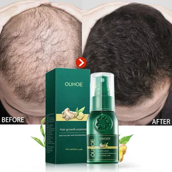 Ginger Hair Growth Products Anti Hair Loss Serum Spray Fast Growing Hair Care Oil Beauty Health Scalp Treatment Liquid Men Women 1