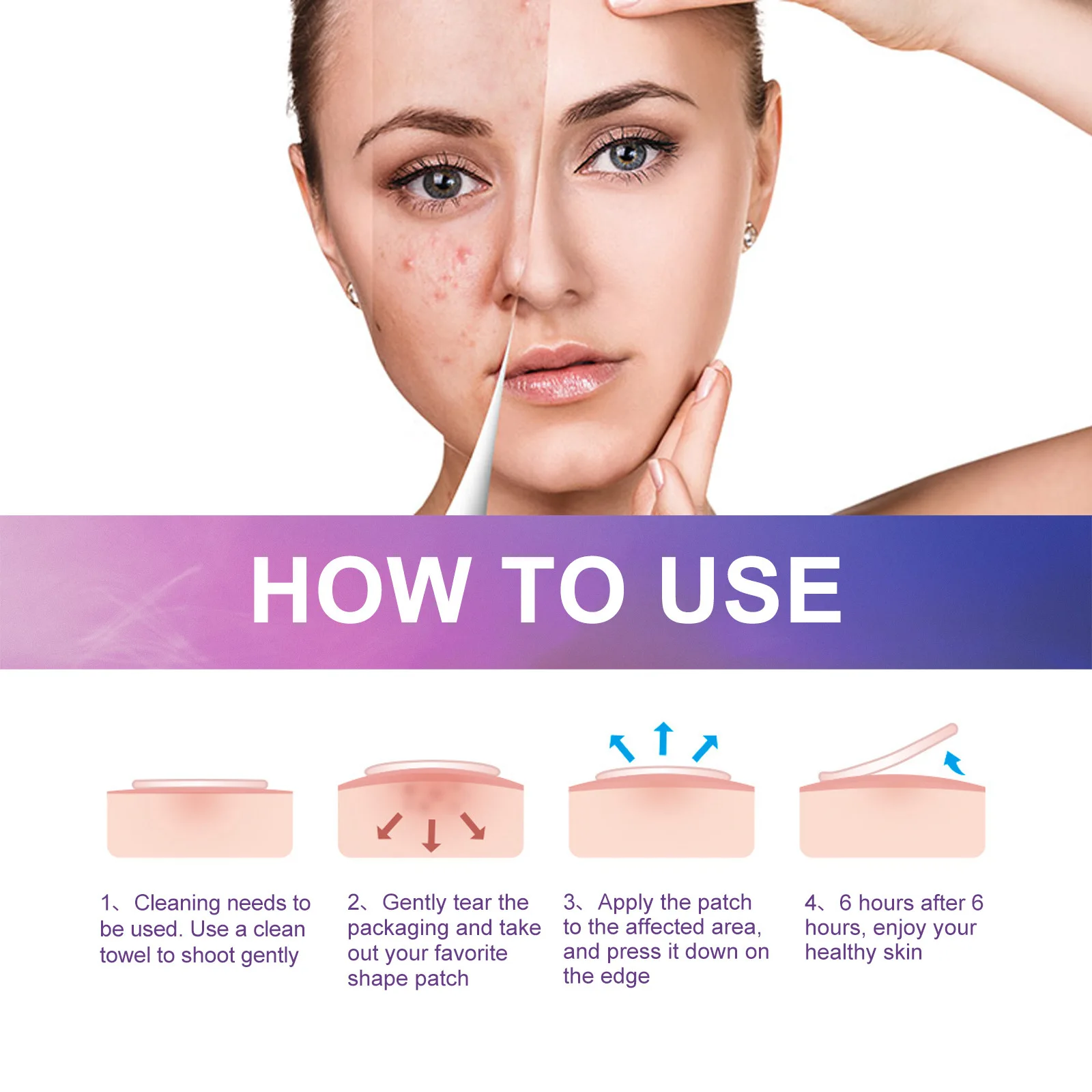 EELHOE наклейка на прыщи от акне невидимые прыщики патчи впитывающие кожу пятна