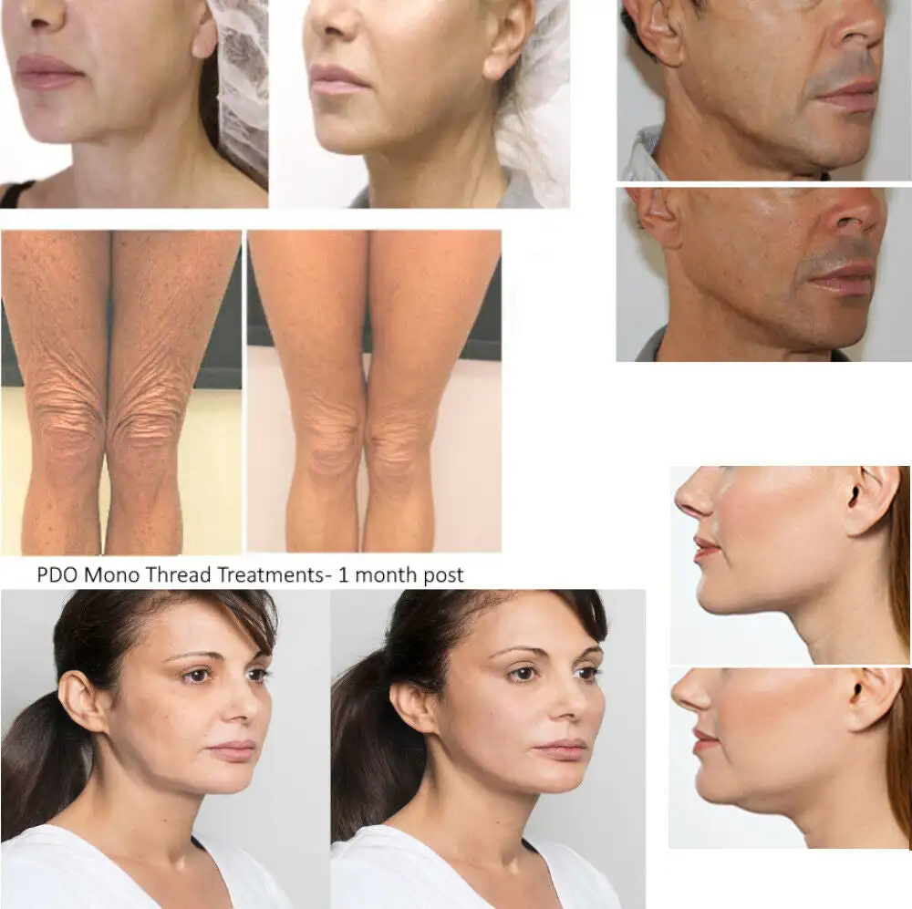 Китайские товары/поставщики лидер продаж безопасная Корейская ультра V