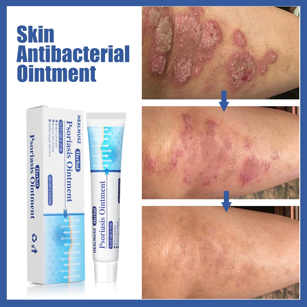 Рисунок 3 - Мазь для местной кожи 20 г