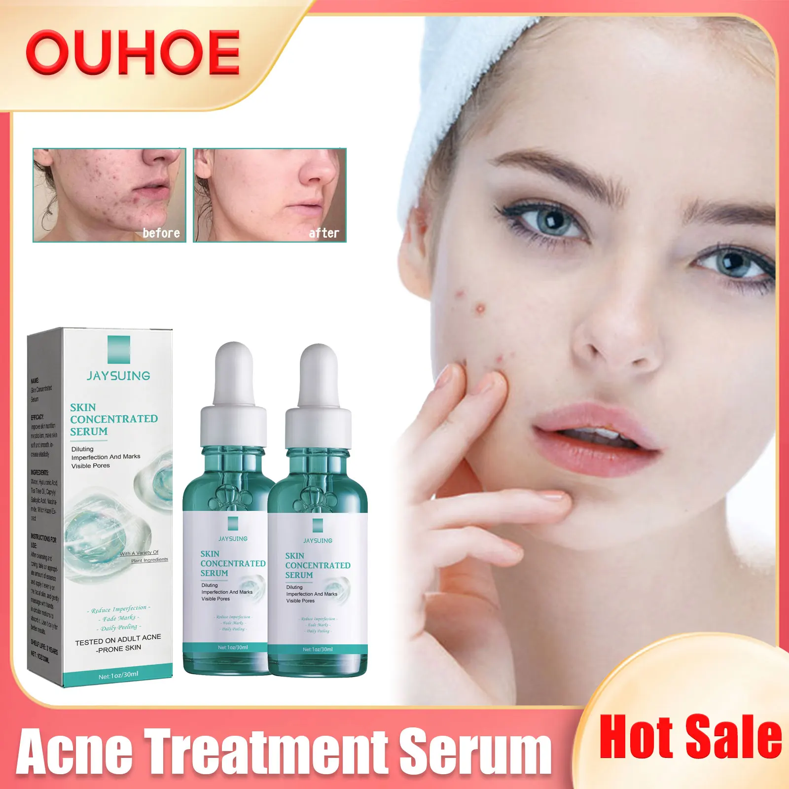 

Acne Remover Serum Smoothing Moisturizing Shrink Pores Hydrating Brighten Repair Oil Control Blemishes Pimples Treatment Essence