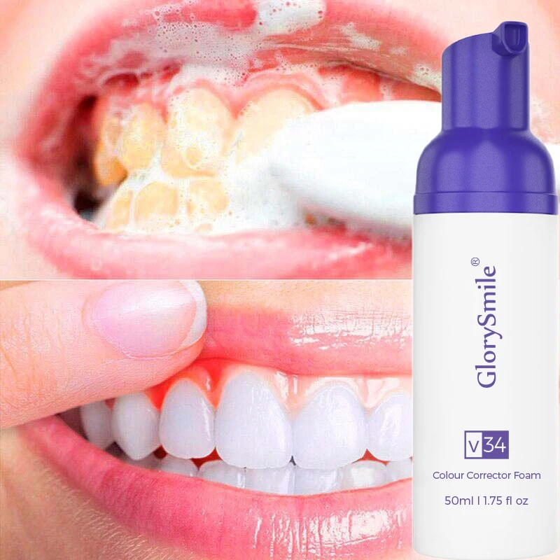 

GlorySmile 50ml Mousse Toothpaste V34 Colour Corrector Purple Tooth Stain Removal Teeth Whitening Foam Dental Hygiene Care