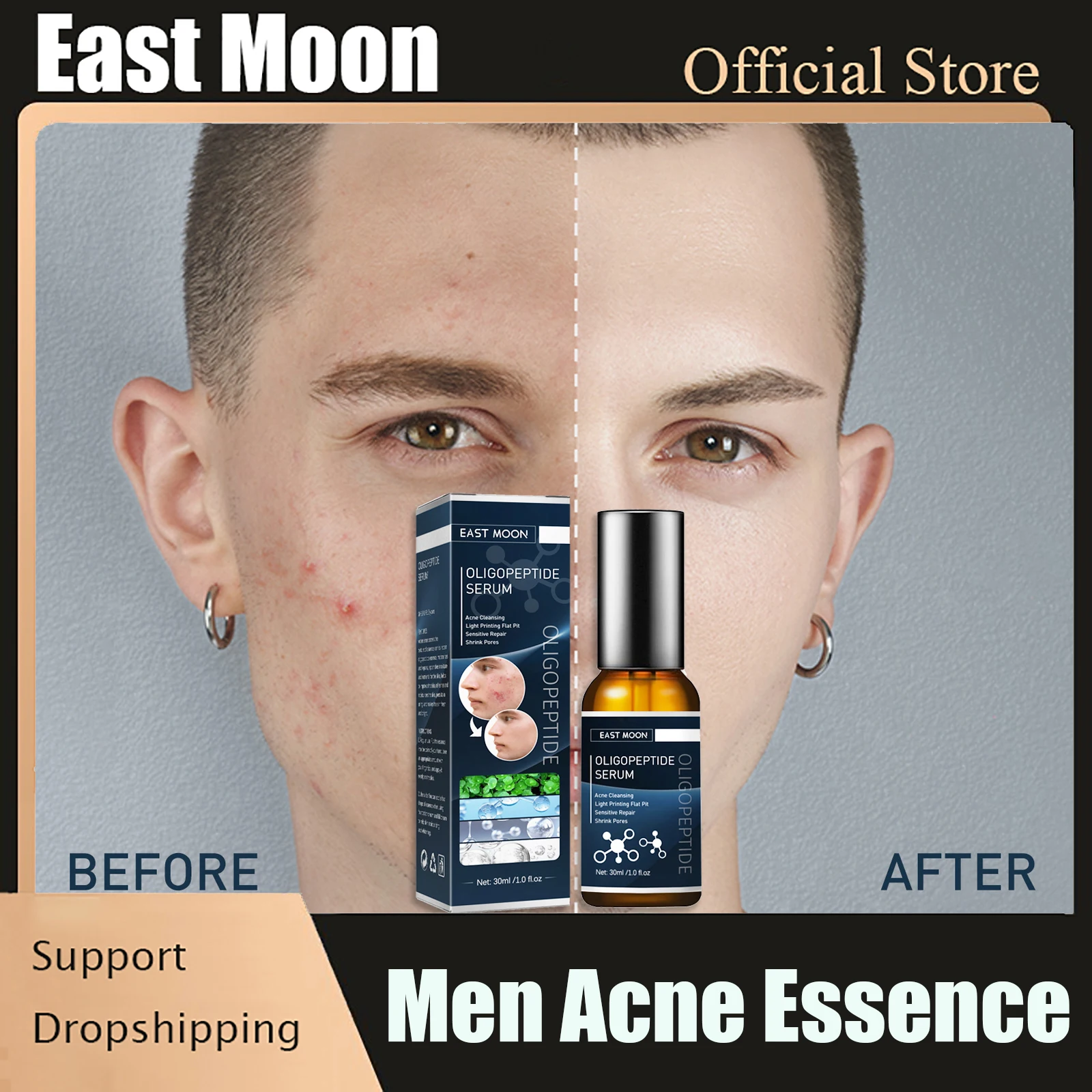 

Men Acne Removal Essence Deep Cleansing Lighten Spots Shrink Pore Whiten Skin Care Acne Treatment Face Serum Man Beauty Care