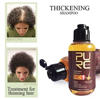 2pcs ginger herbal hair growth shampoo 100ml scalp treatment anti hair loss repair hiar for woman man hair grow products