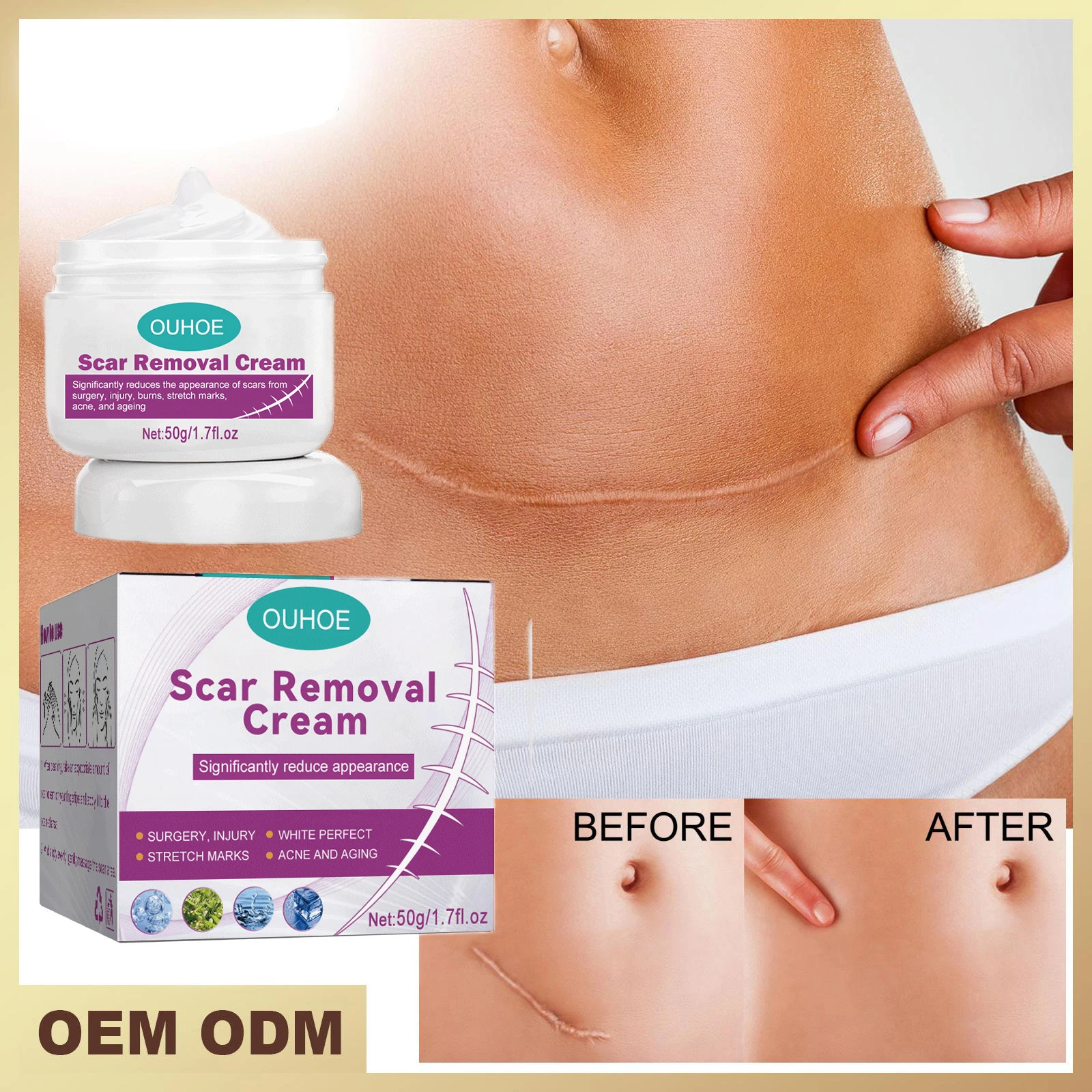 

Scar Repair Cream Fade Scar Surgery Scar Improves Fine Lines Facial Trauma Moisturizing Smooth Skin Care Hydrogel Disaar 50g