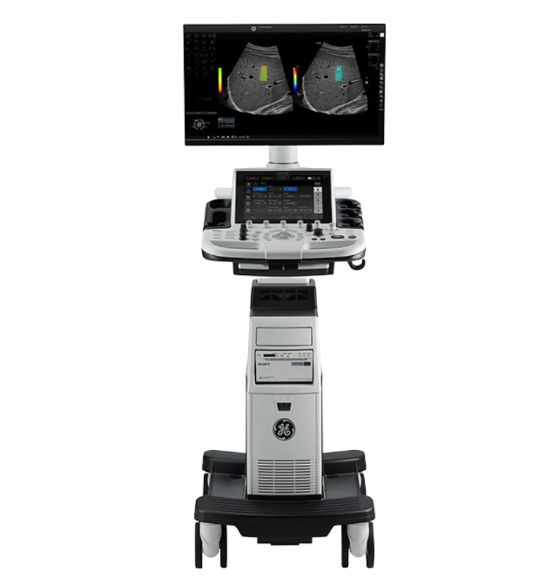 Высокочастотный Профессиональный Новый ультразвук GE LOGIQ P9
