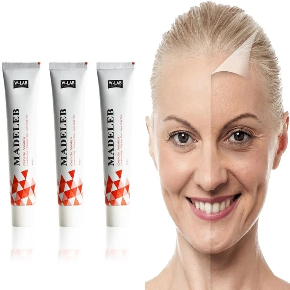 

Madeleb Skin Renewal Cream 40 ml Skin Wounds Psoriasis and Eczema Acne Problems Cell Regeneration Acne Treatment