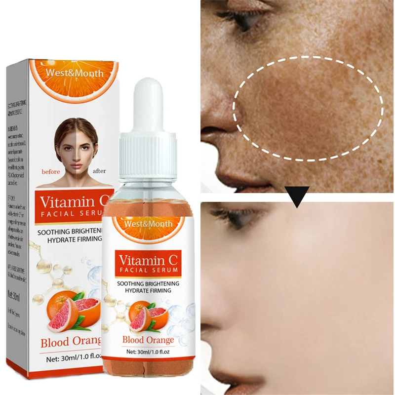 

Vitamin C Whitening Freckle Face Serum Remove Dark Spots Pigmentation Anti-Aging Hyaluronic Acid Moisturizing Brighten Skin Care