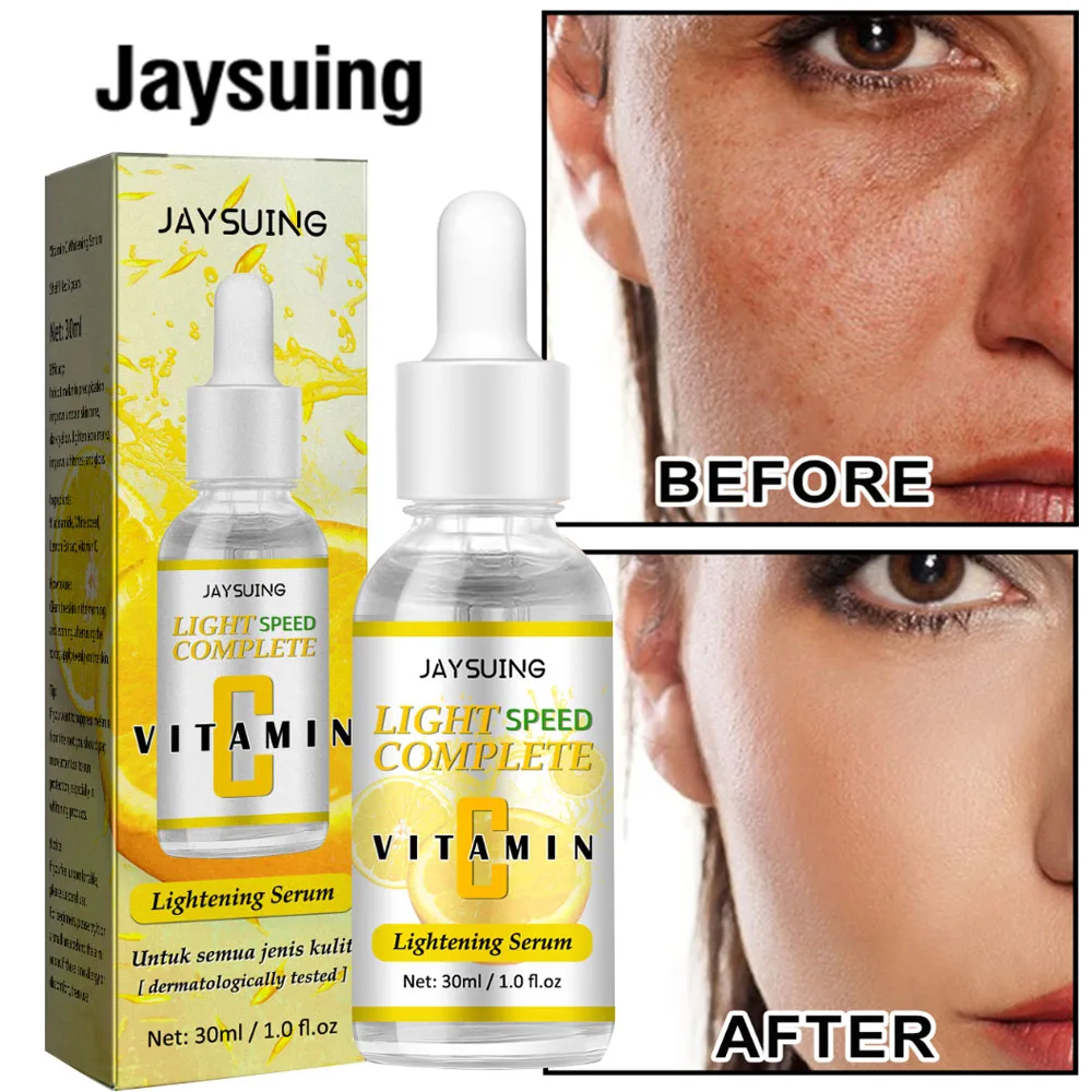 

Vitamin C Whitening Freckle Serum Fade Dark Spots Remove Melanin Melasma Removal Acne Brightening Moisturizing Beauty Skin Care