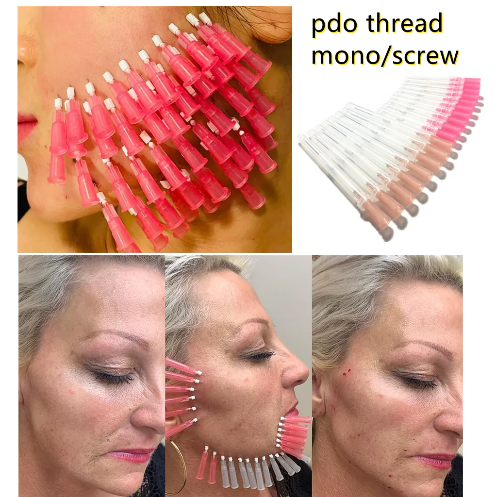 

2022 Hilos Pdo Pcl Plla Thread Nose Face Lift Cog 3D/4D/6D Blunt Molding Fishbone 18G Mono/Mono Screw /Tornado Screw Pdo Threads