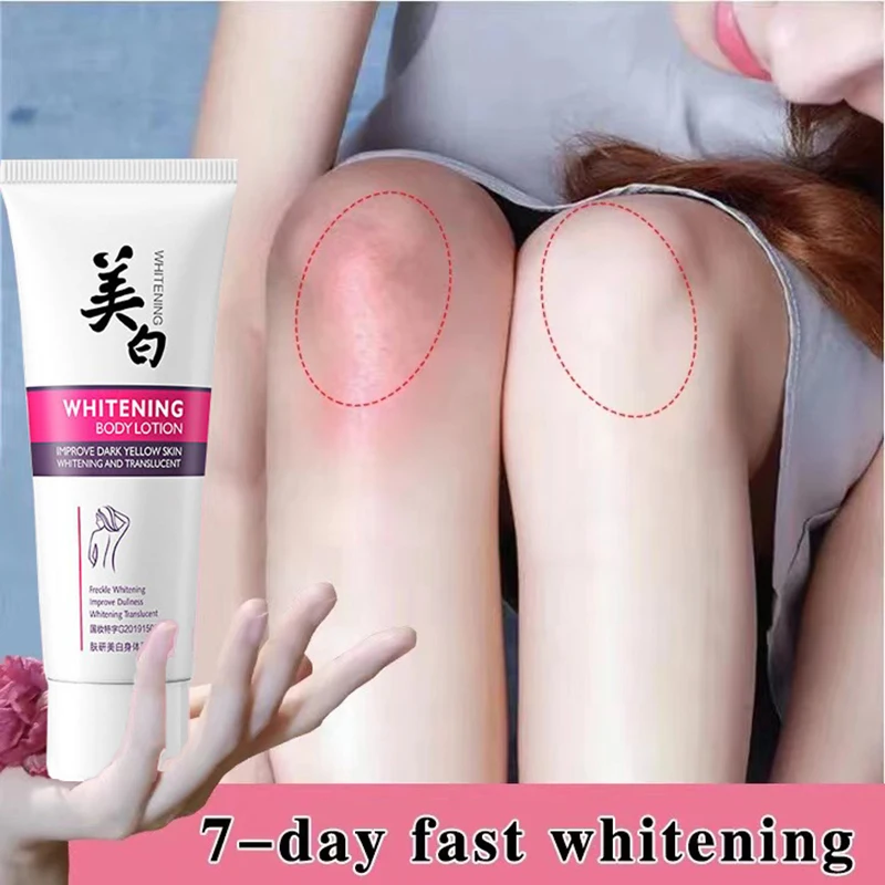 

100g Whitening Body Lotion Legs Knee Elbow Hip Private Parts Brighten Armpit Whitening Cream Remove Dark Spots Skin Care Product