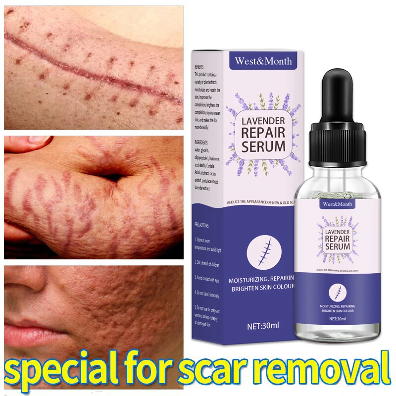 

Acne Scar Removal Serum Gel Stretch Marks Treatment Pimples Acne Spots Surgical Scars Burn Remover Smooth Whitening Skin Care