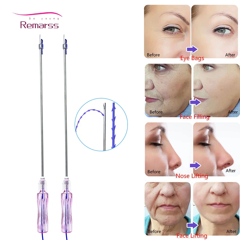 

Free Shipping Korea Pdo PCL PLLA Faciales Lifting Anti-aging Skin Firming Hilos Tensores Pdo Thread Cog Mono Screw Face Lift