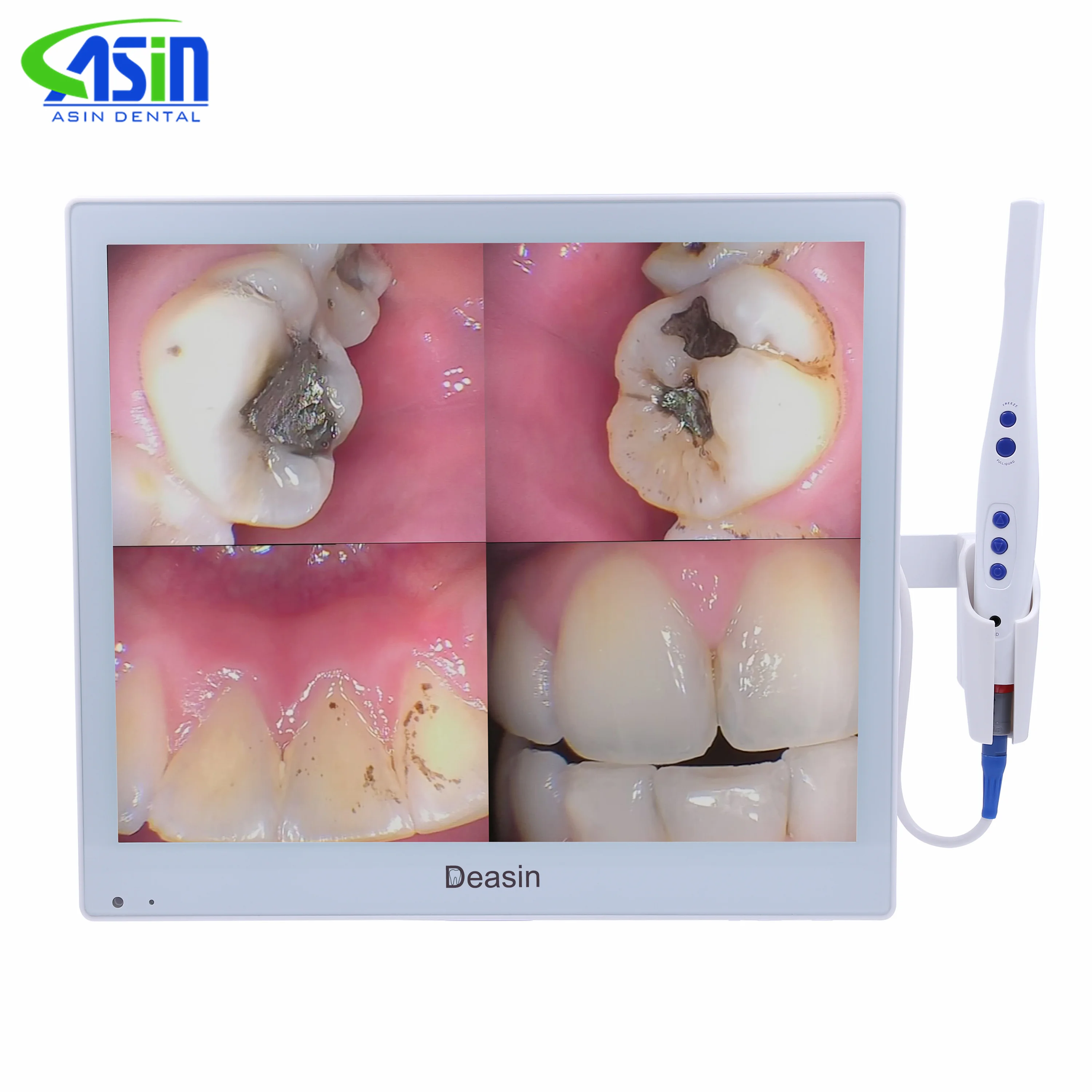 

17 Inch Screen Dental Intra Oral Camera with Monitor Digital Intraoral Endoscope Camera CMOS Scanner Medical Equipment Oral