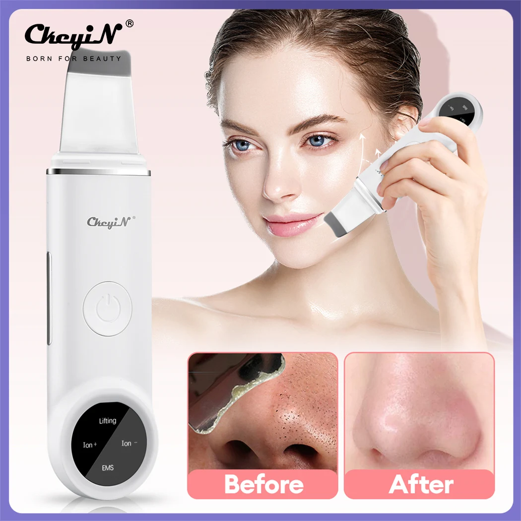 

CkeyiN Ultrasonic Skin Scrubber 24000HZ EMS Ion Vibration Face Peeling Spatula Lifting Acne Blackhead Remover Pore Deep Cleaner