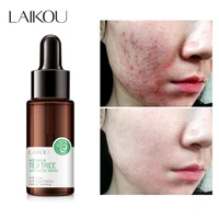 tea tree acne treatment effective oil control serum remove pimples fade acne scar repair face moisturizing anti acne skin care