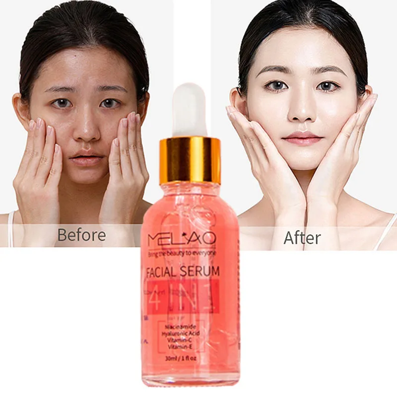

Whitening Serum Niacinamide Face Essence Multifunctional Shrink Pores Freckle Brighten Improve Acne Moisturizing Skin Care