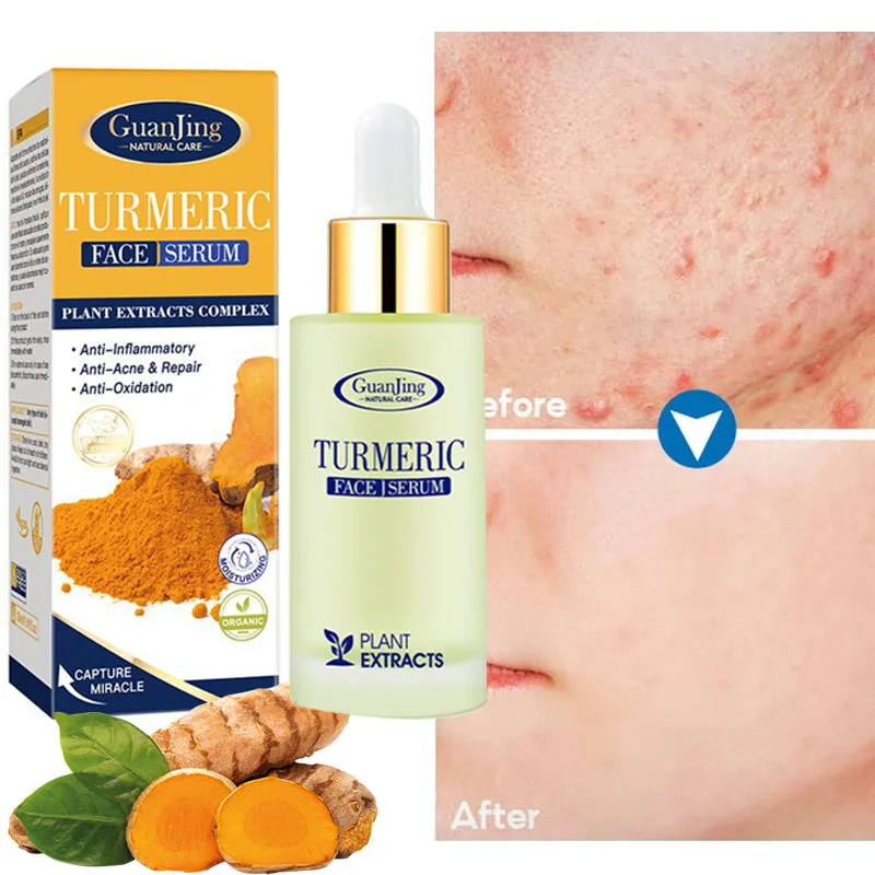 

Turmeric Face Serum Remove Acne Marks Essence Shrinks Pores Whitening Brighten Moisturizing Anti-aging Skin Care Cosmetic 30ml
