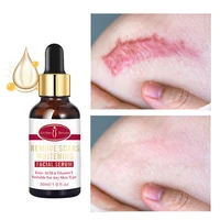 scar repair serum herbal acne scar removal gel fade stretch mark burn surgery scar treatment whitening smooth skin body care 30g