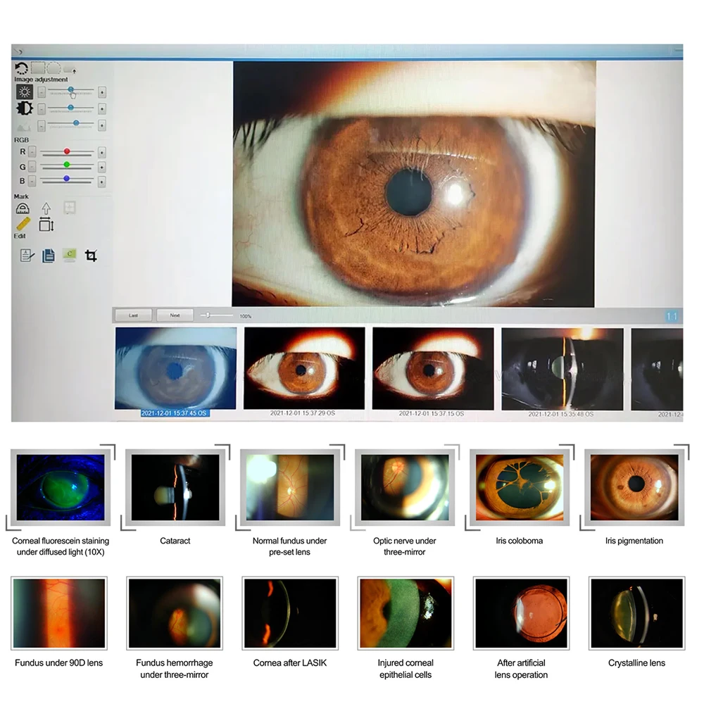 Оптический увеличитель 5 шагов лампа с разрезом цифровой адаптер лучевой