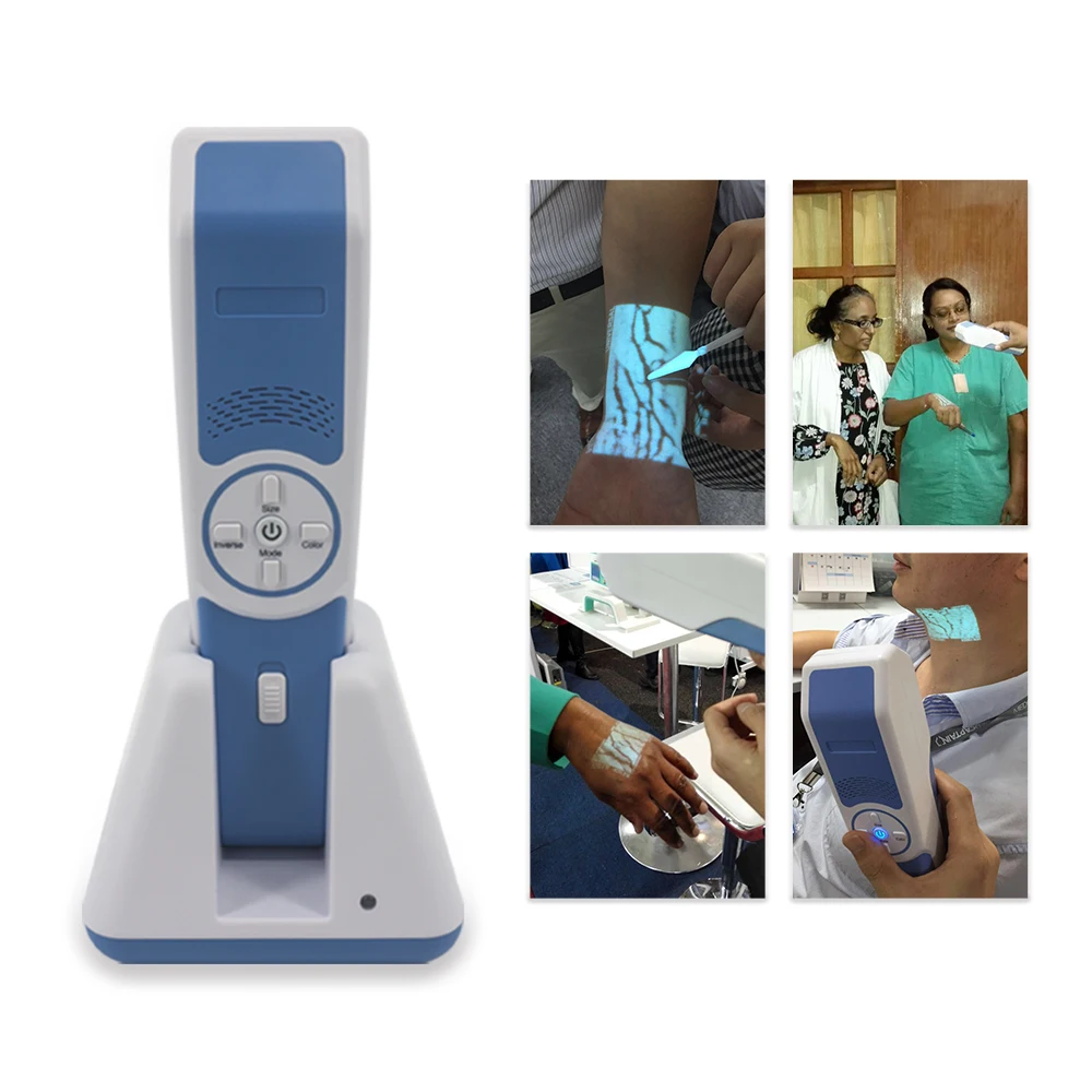 

Hand Held Infrared Detector Medical Device Viewer Portable Vein Finder Machine Nurse Assistance Vascular Injection Locator