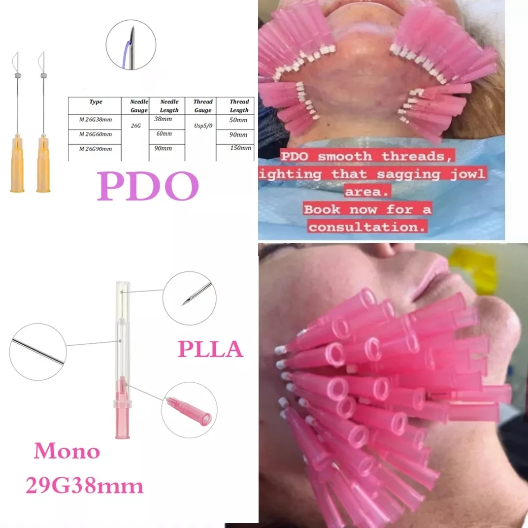 Бесплатная доставка 10 шт./20 шт./50 шт. CE PDO PCL PLLA 29g38 мм резьба моно-винт для лица бровей для подтяжки кожи губы нитки