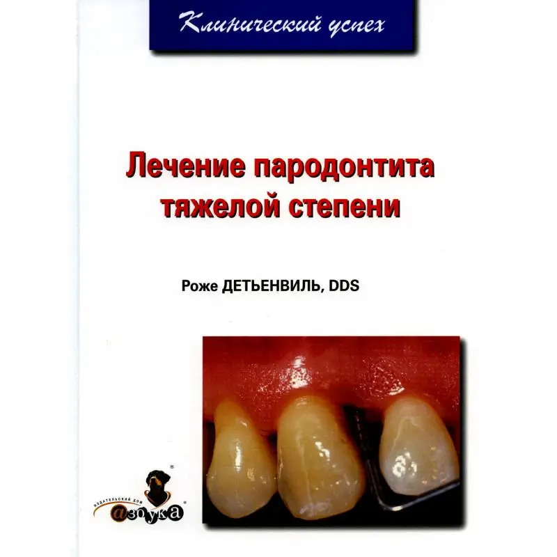 Фото Книга Лечение пародонтита тяжелой степени Детьенвиль Роже №1