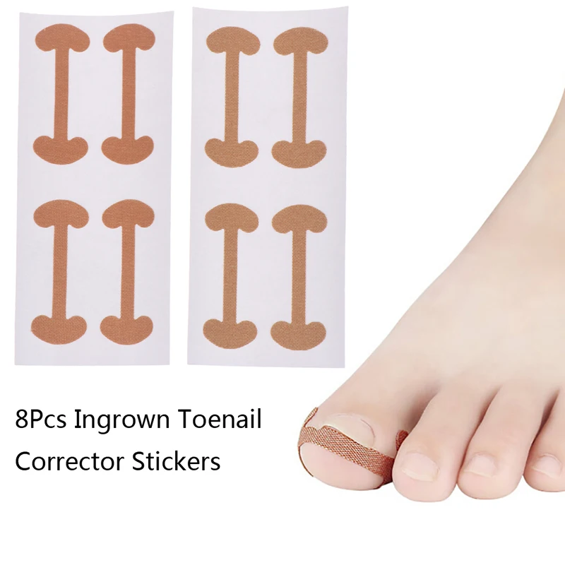 

2Sheet 8Pcs Ingrown Toenail Paronychia Treatment Foot Corrector Stickers Toe Nail Repair Nail Corrector Nail Patch