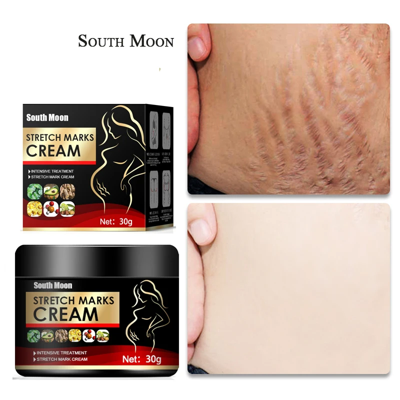 

Acne Scar Removal Cream Stretch Marks Treatment Repair Gel Remove Pimples Surgical Scars Whitening Smooth Skin Care Pigmentation