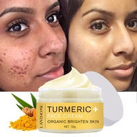 turmeric whitening freckle face cream remove dark spots lighten melanin acne treatment anti aging moisturizer smooth skin care