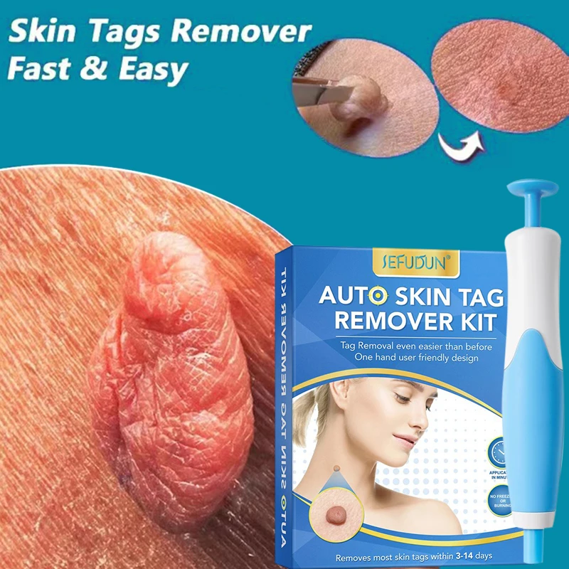 

Skin Tag Remover Pen Painless Wart Mole Remover Non Toxic Face Care Mole Wart Tools Acne Removal Pen Face Care Beauty Devices