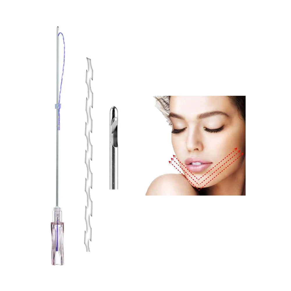 Недорогая Антивозрастная новая линия V-образной плоской Z-образной резьбы для