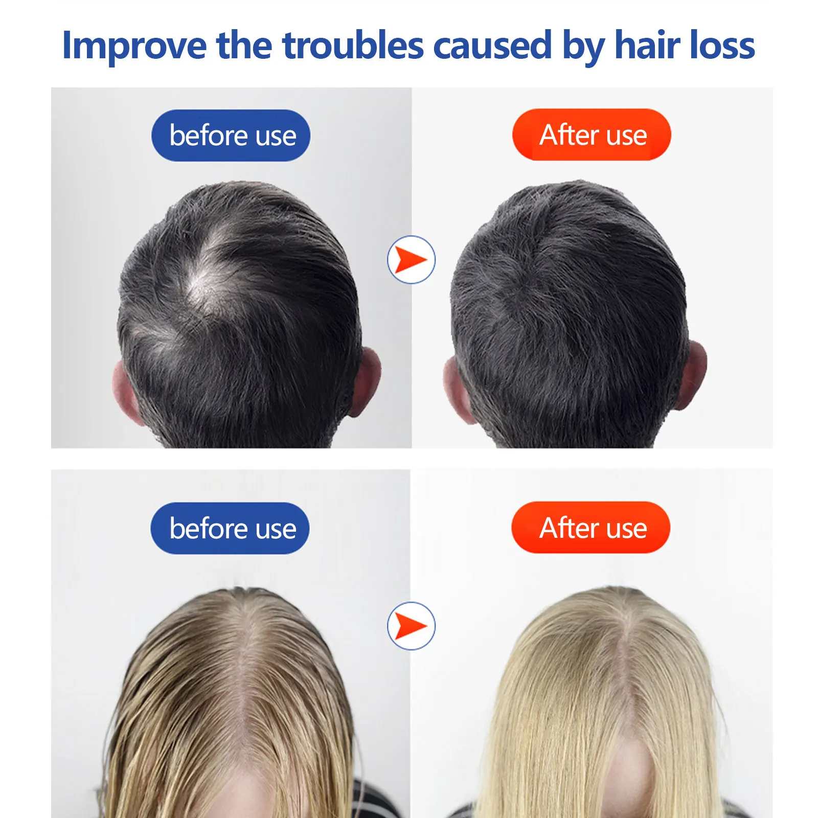 Инфракрасная шапочка для терапии отрастания волос с 3 регулируемыми скоростями