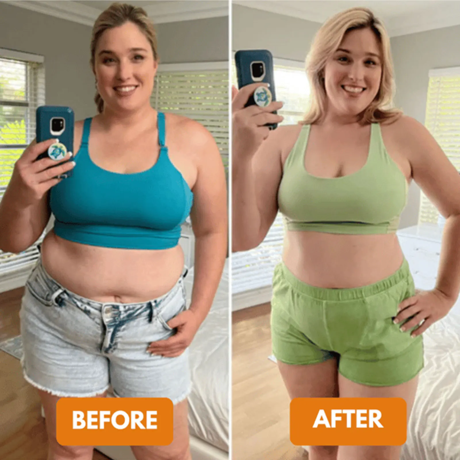 Ультразвуковой аппарат для удаления липидов - Устройство похудения CS-103