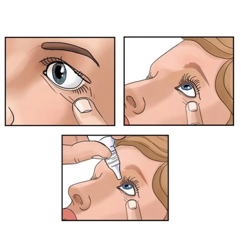 Закапывание глаз ребенку. Как правильно закапывать глазные капли. Закапывание глаз ребенку. Закапывание капель в глаза детям. Капает капли в глаза.