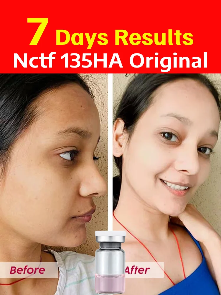 

135HA Pdrn Pore Shrinking Dark Spots Face Serum Whitening For Glowing Hyaluronic Acid Korean Collagen Facial Serum Skin Care