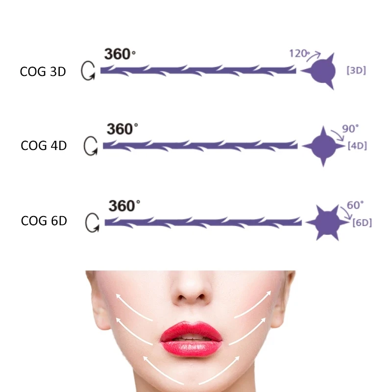 

Hot sale PDO Thread Lifting Cog 3D 4D 6D Face lift Fish Bone Hilos Strong V-line Nose Line Double Needle 5 pcs/pack