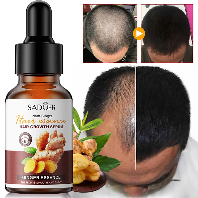 

Fast Hair Growth Essential Oils Ginger Anti Hair Loss Serum Nourishing Soften Scalp Treatment Prevent Hair Thinning Dry Repair