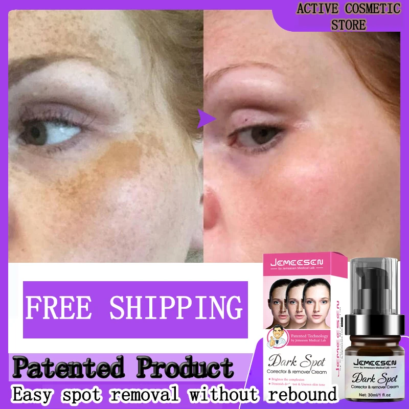 

Whitening Freckle Cream Remove Melasma Acne Spot Pigment Melanin Dark Spots Melasma Remover Moisturize Anti-aging Face Care