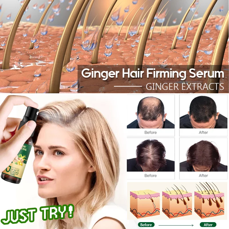Koufeng Ginger Hair Growth Spray Serum For Anti Hair Loss Essential Oil Fast Treatment Prevent Hair Thinning Dry Frizzy Repair