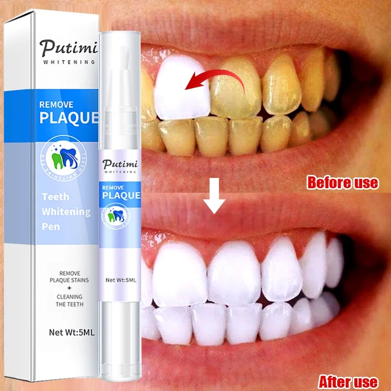 

Teeth Whitening Gel Pen Serum Whiten Bleach Tooth Care Remove Plaque Stains Fresh Breath Oral Hygiene Care Dental Dentistry Tool